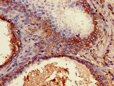 B2M / Beta 2 Microglobulin Antibody