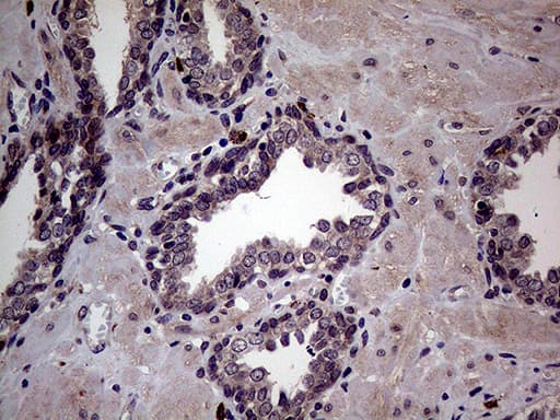 MAPK8IP1 / JIP1 Antibody (clone OTI1D9)