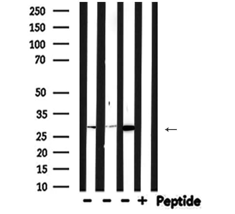 Polyclonal Rabbit anti-Human CA2 / Carbonic Anhydrase II Antibody (IHC, WB)