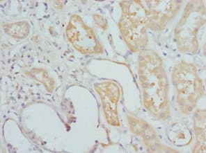 Polyclonal Rabbit anti-Human DLX2 Antibody (IHC)