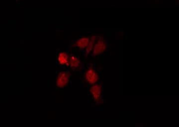 S100A5 Antibody