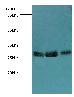 AK2 / Adenylate Kinase 2 Antibody (aa1-232)