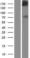 FGD5 Protein (Over-Expression Lysate Myc-DDK (Flag))