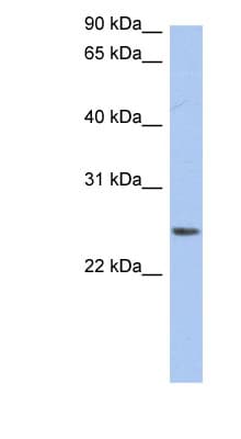 NRSN2 Antibody (aa71-120)