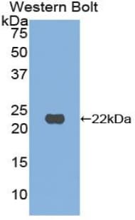 RBP4 Antibody (aa22-196)