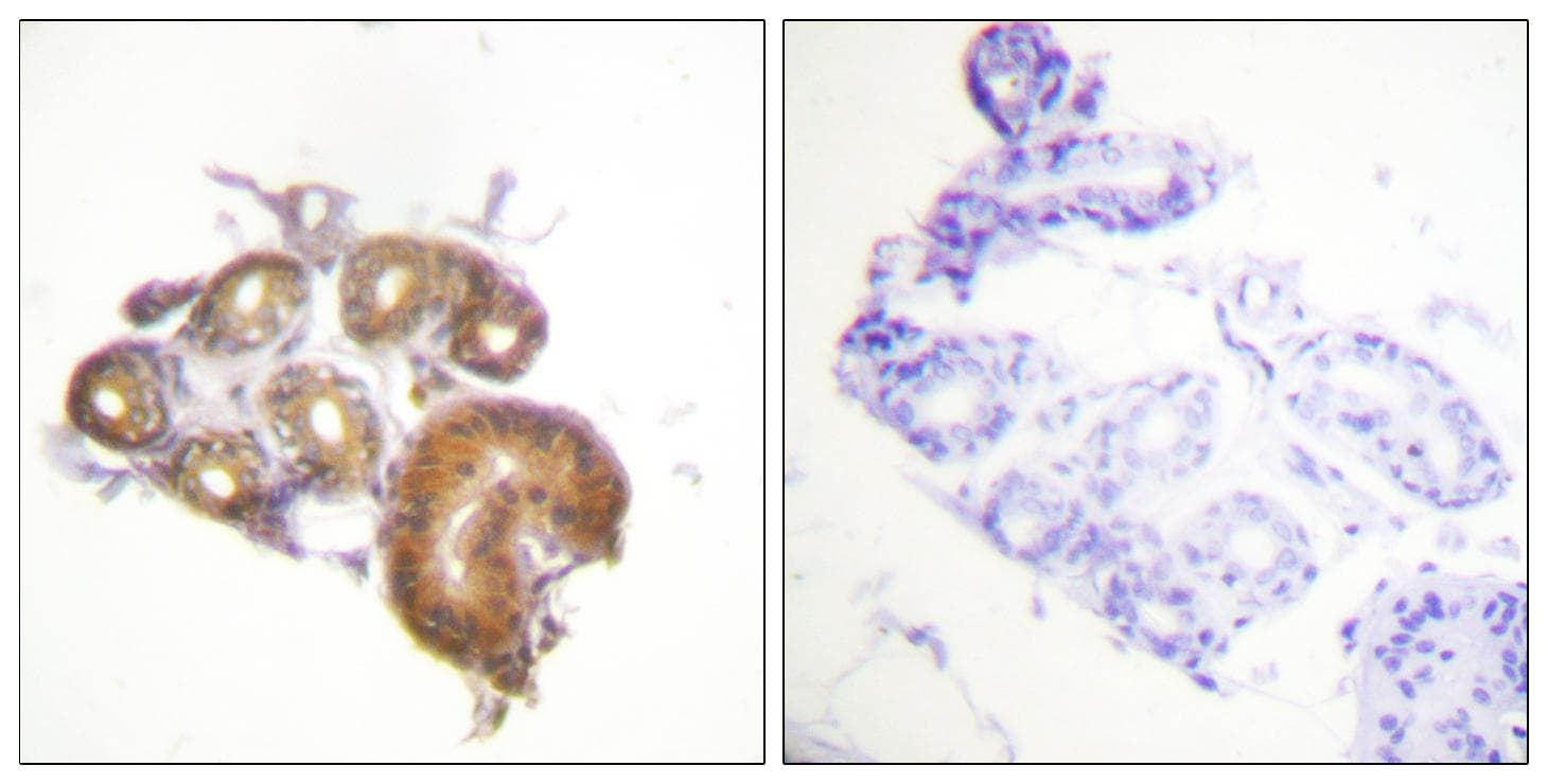 Polyclonal Rabbit anti-Human ETK / BMX Antibody (p40, IHC, WB)