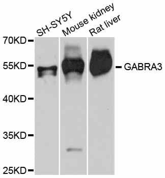 Polyclonal Rabbit anti-Human GABRA3 Antibody (WB)