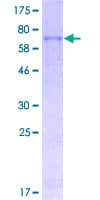 Human PH / PAH Protein (Recombinant GST)
