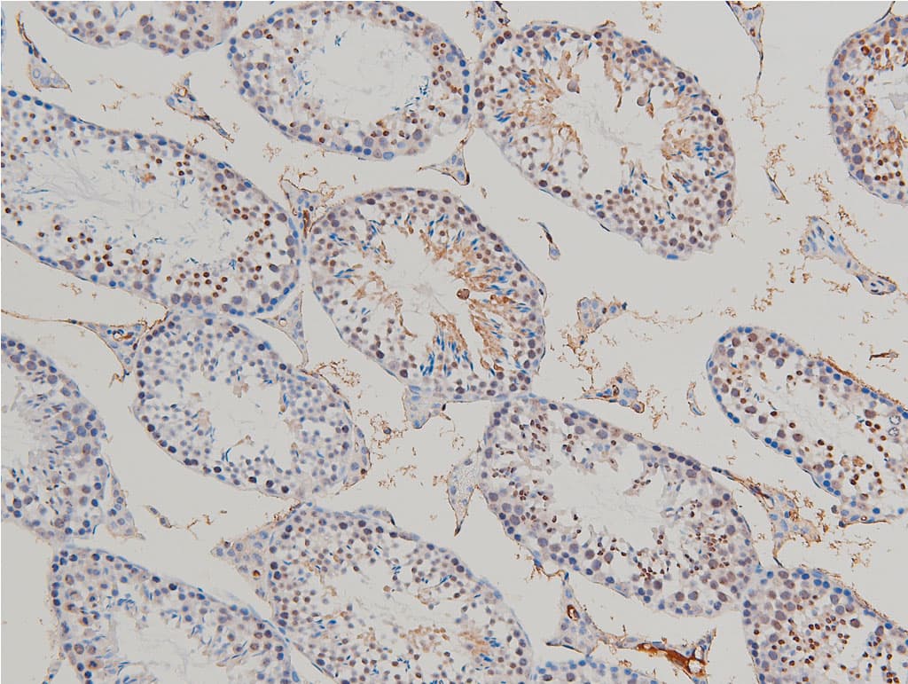CFL1 / Cofilin Antibody (phospho-Ser3)