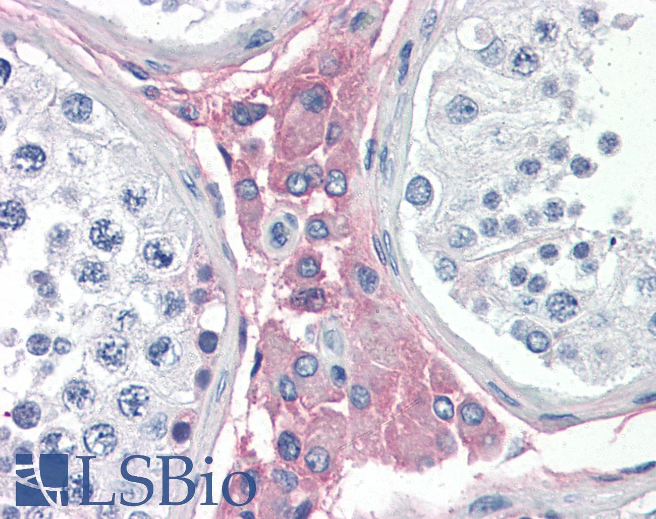 IHC-plus™ Laminin Antibody