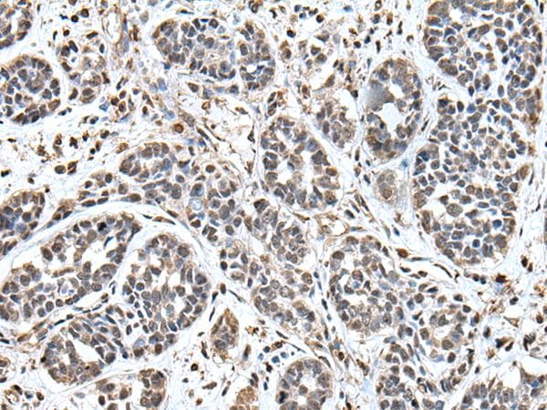 UPK3A / UPK3 / Uroplakin III Antibody