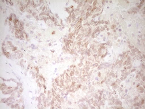 Monoclonal Mouse anti-Human TNNT2 / CTNT Antibody (clone OTI8B5, Carrier-free, IHC, WB)