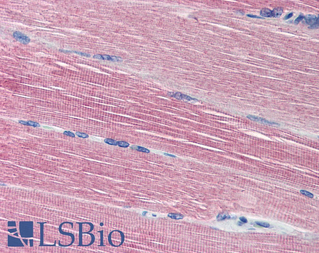 IHC-plus™ Polyclonal Rabbit anti-Human ACHE / Acetylcholinesterase Antibody (N-Terminus, IHC, WB)