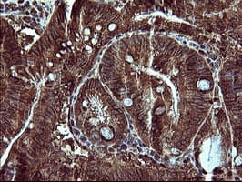 MAP2K1 / MKK1 / MEK1 Antibody (clone OTI5D3)