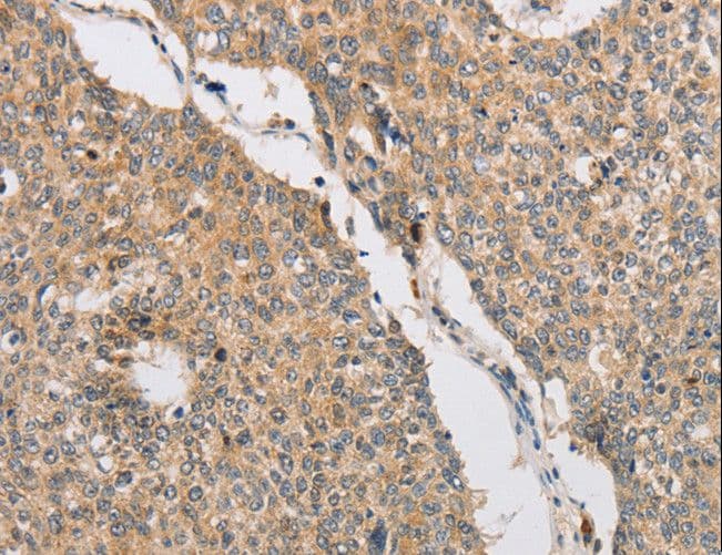 ART3 Antibody