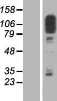 SCP1 / SYCP1 Protein (Over-Expression Lysate Myc-DDK (Flag))