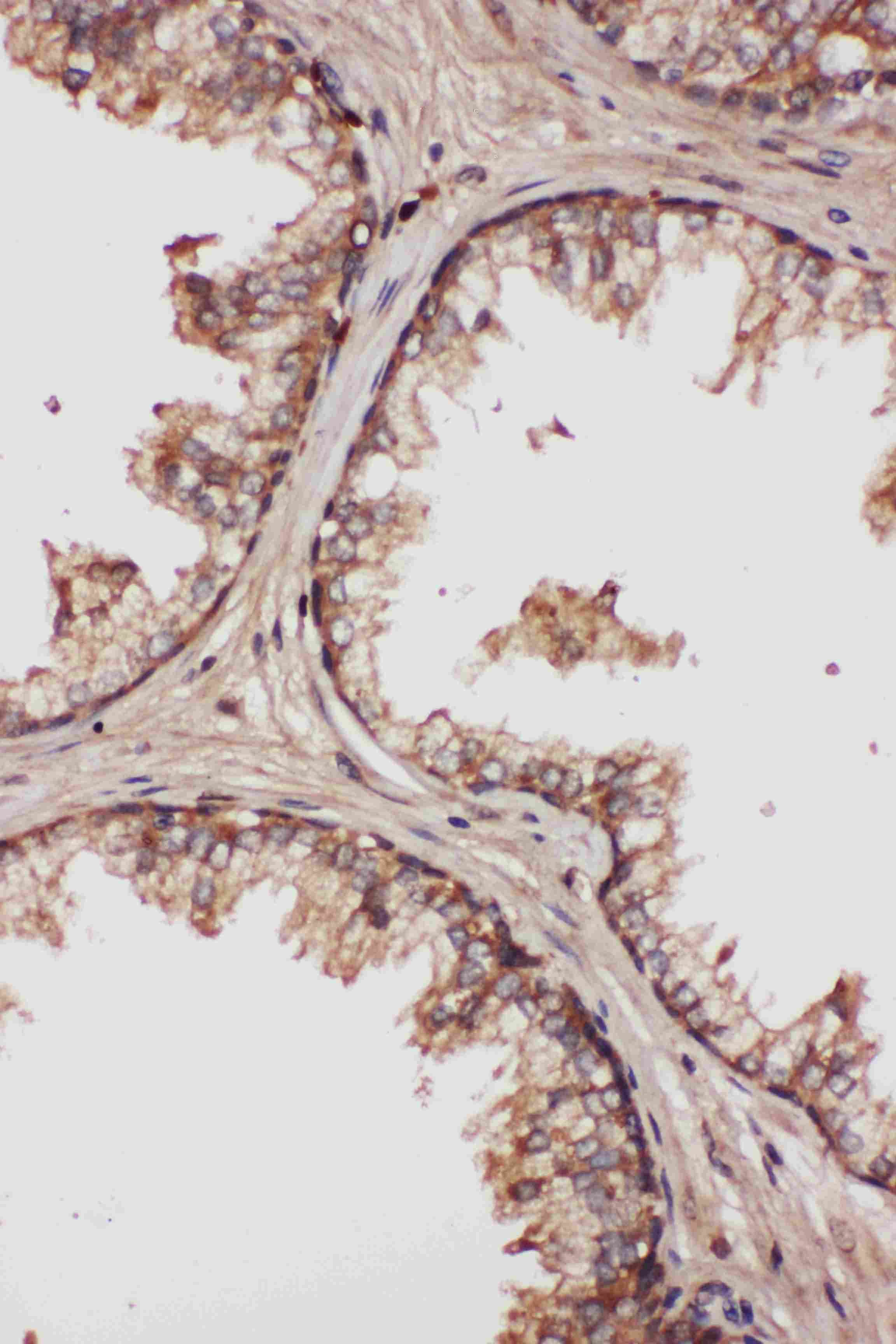 LCN1 / Lipocalin-1 Antibody (aa110-124)