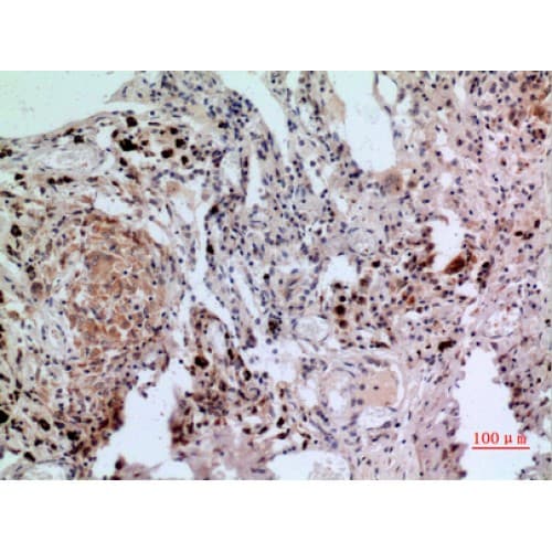 NFATC1 / NFAT2 Antibody (881-930 aa, C-terminal)