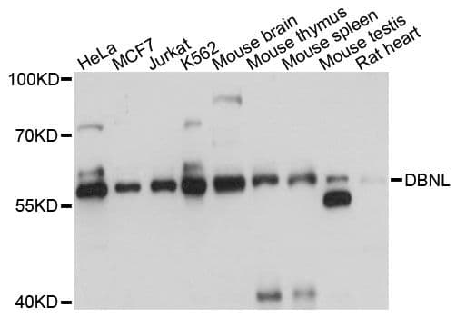 SH3P7 / HIP-55 Antibody