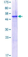 Human SPIN / SPIN1 Protein (Recombinant GST)