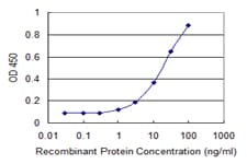 PANK4 Antibody (clone 4F10)