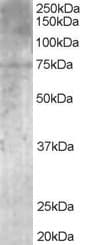 IHC-plus™ MPP5 Antibody (aa174-187)