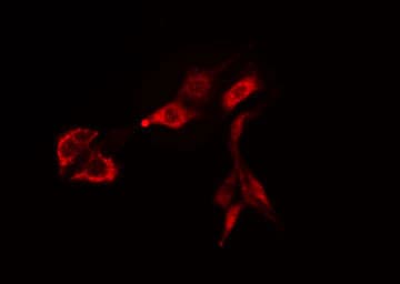 Polyclonal Rabbit anti-Human RAB38 Antibody (IF, WB)