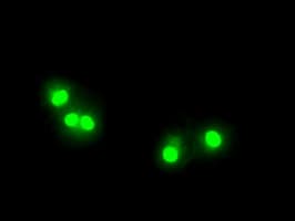 Monoclonal Mouse anti-Human ZFP36 / Tristetraprolin Antibody (clone OTI8B5, IHC, IF, WB)