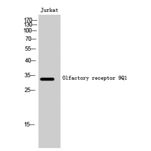 OR9Q1 Antibody (200-280 aa, C-terminal)