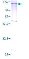 Human L3MBTL1 Protein (Recombinant GST)