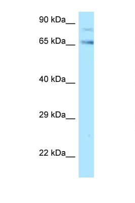 Polyclonal Rabbit anti-Human TF / Transferrin Antibody (aa417-466, WB)