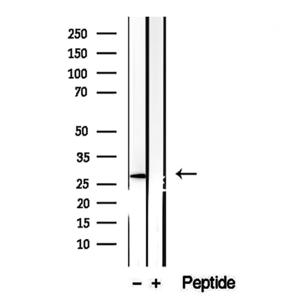 CHMP4B Antibody