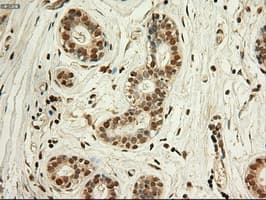 Monoclonal Mouse anti-Human MYC / c-Myc Antibody (clone OTI1A6, IHC, IF, WB)