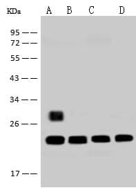 Polyclonal Rabbit anti-Human RPS5 / Ribosomal Protein S5 Antibody (IHC, IF, WB)