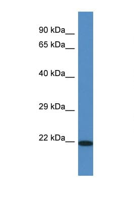 Polyclonal Rabbit anti-Rat TMEM147 Antibody (aa40-89, WB)