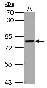 Polyclonal Rabbit anti-Human Cytokine IK Antibody (WB)