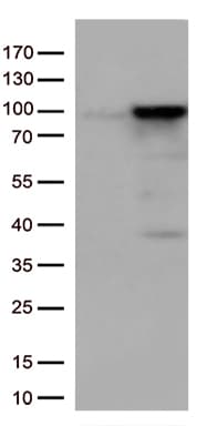 EWSR1 / EWS Antibody (aa256-447, clone OTI3F6, Carrier-free)