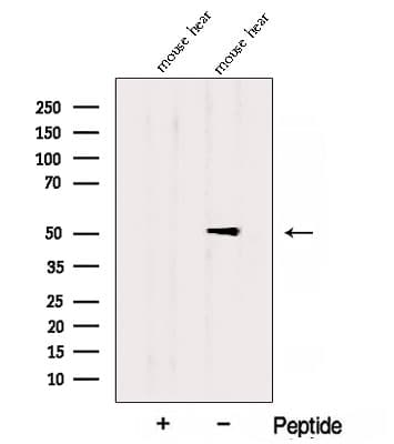 ADHFE1 Antibody