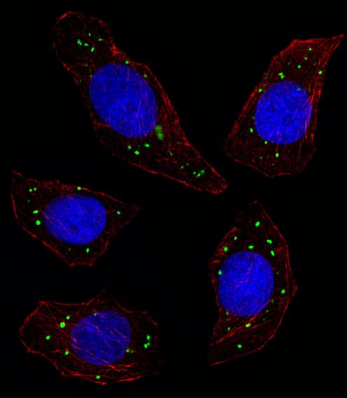 MER / MERTK Antibody