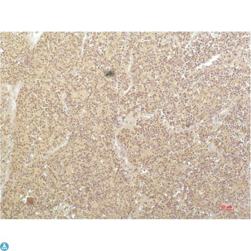 Monoclonal Mouse anti-Human SGK1 / SGK Antibody (IHC)
