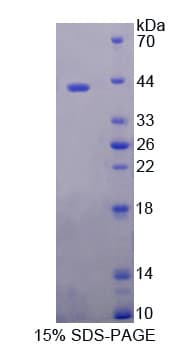 Human DNASE2 / DNase II Protein (Recombinant His-T7)