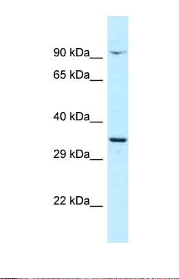 CTNNBL1 / NAP Antibody (aa108-157)
