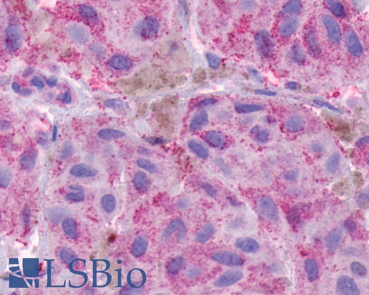 PathPlus™ TACR2 / NK2R Antibody (C-Terminus)