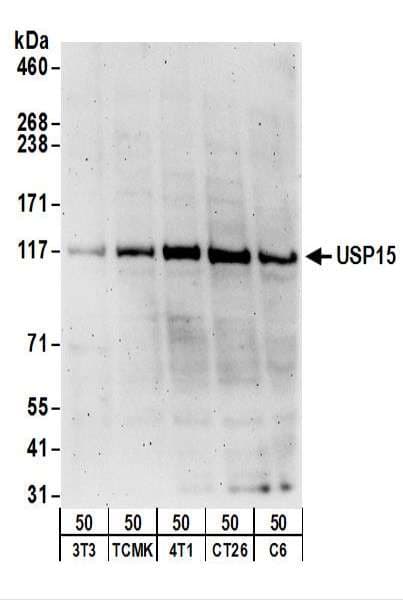 IHC-plus™ Polyclonal Rabbit anti-Human USP15 Antibody (aa960-C-term, IHC, WB)