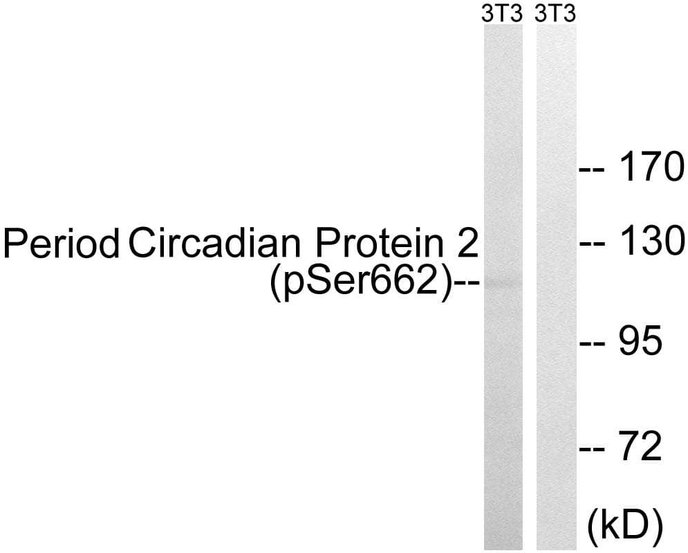 PER2 Antibody (phospho-Ser662)