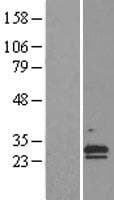 CLCF1 Protein (Over-Expression Lysate Myc-DDK (Flag))