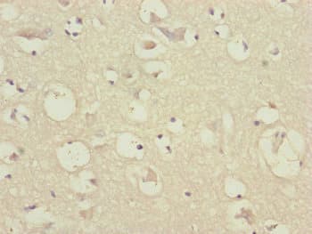 Translokin / CEP57 Antibody