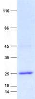 Human NDUFS7 Protein (Recombinant His, N-Terminal)