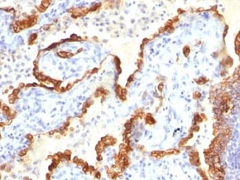 KRT18 / CK18 / Cytokeratin 18 Antibody (clone KRT18 Cocktail)