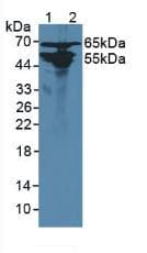 AGXT2 Antibody